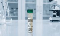 Lyophilized Bacterial EVs Derived from Lactobacillus (100µg vial)